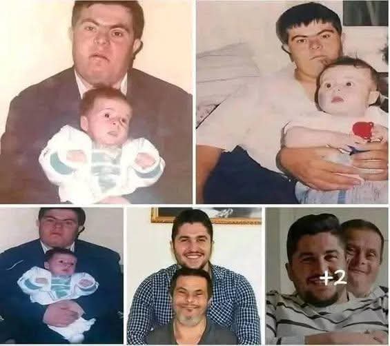 Jad Issa: el padre con síndrome de Down que inspiró a su hijo a convertirse en médico