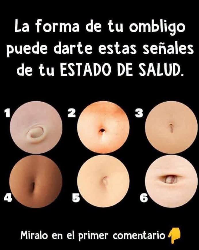 Qué puede indicar la forma del ombligo: cambios normales y señales de alerta