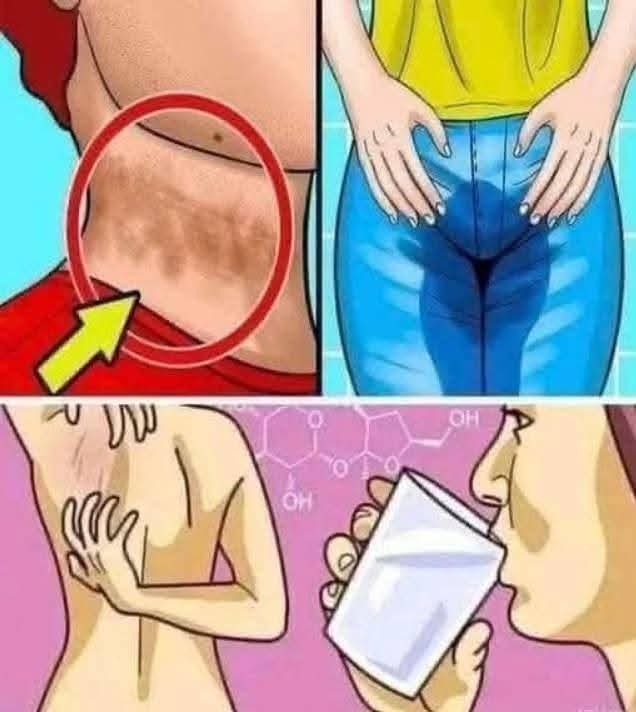 8 señales de glucosa alta en la sangre que no debes ignorar