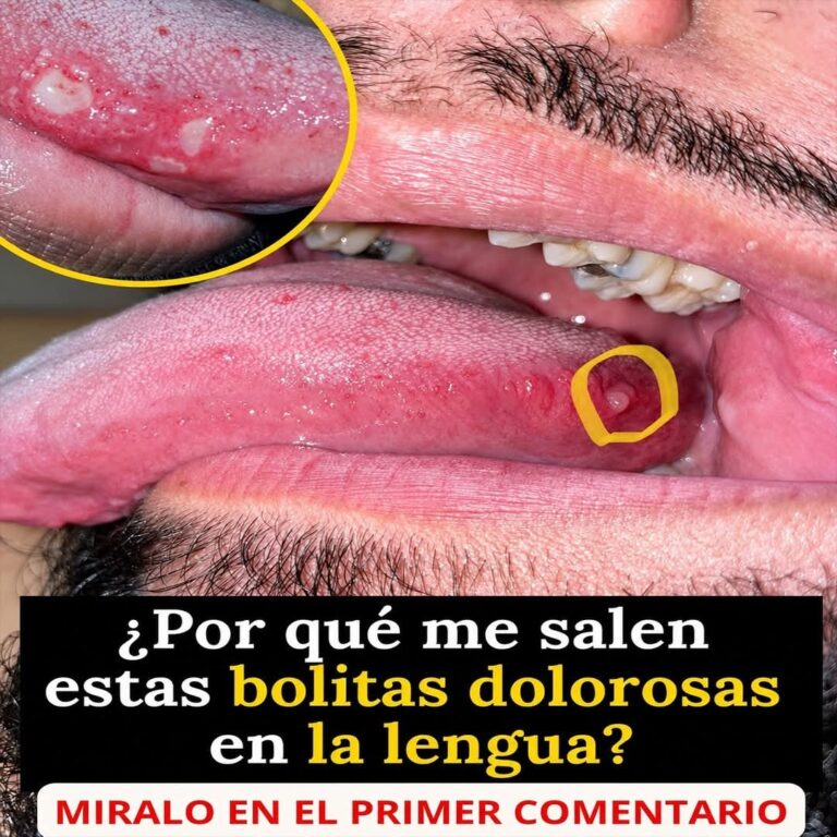 ¿Por qué tengo la lengua blanca? Lo que tu cuerpo quiere decirte