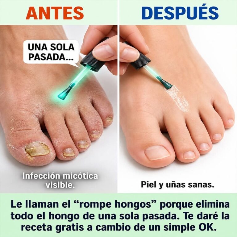 Transforma la Salud de Tus Uñas con un Remedio Natural