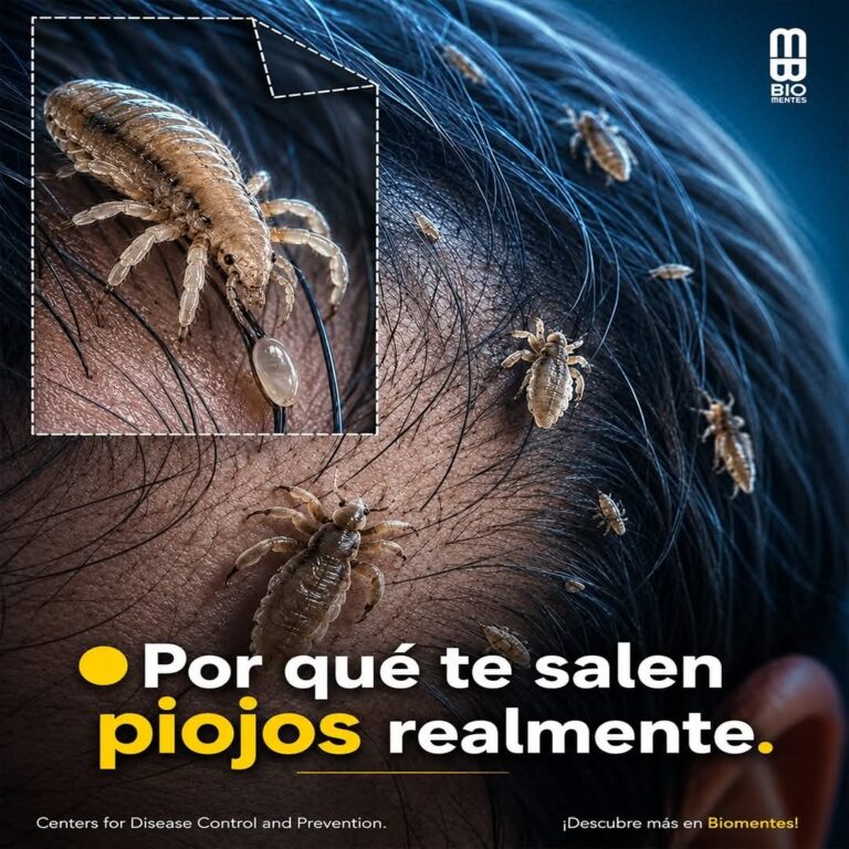 Piojos en los niños