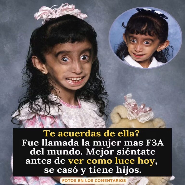 De víctima a inspiración: Lizzie Velásquez y su poderosa lección a los haters