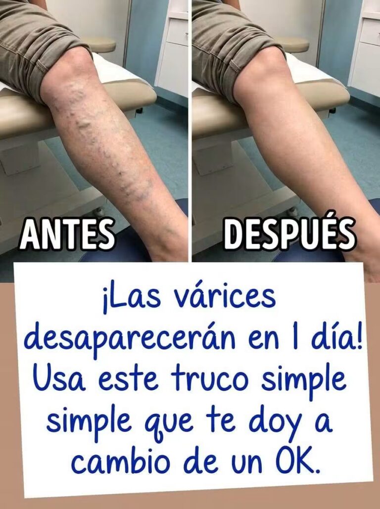 LAS VÁRICES